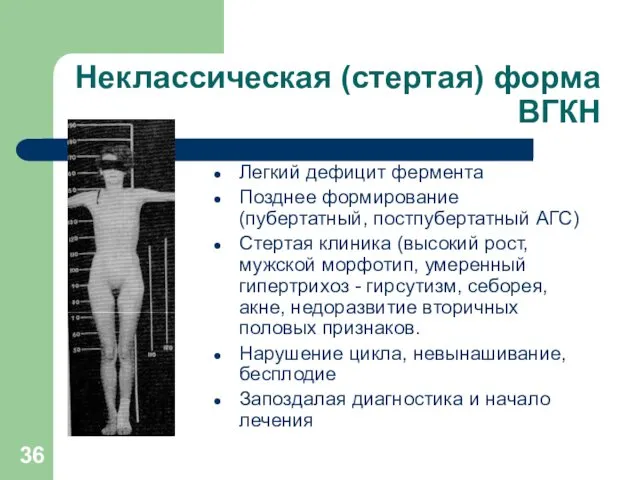 Неклассическая (стертая) форма ВГКН Легкий дефицит фермента Позднее формирование (пубертатный, постпубертатный АГС) Стертая