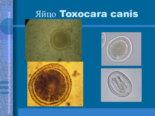 Яйцо Toxocara canis