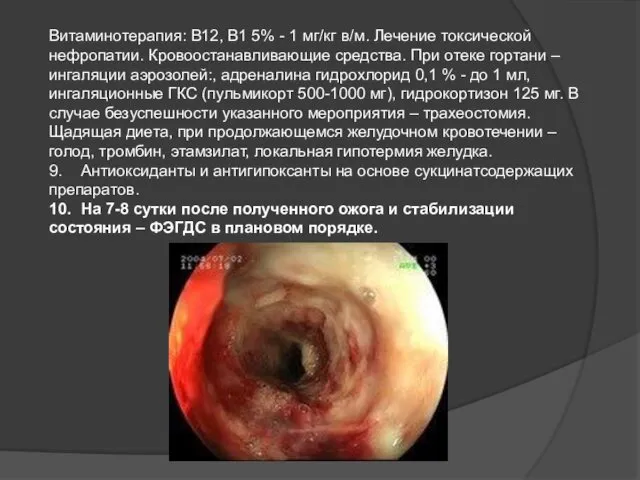 Витаминотерапия: В12, В1 5% - 1 мг/кг в/м. Лечение токсической