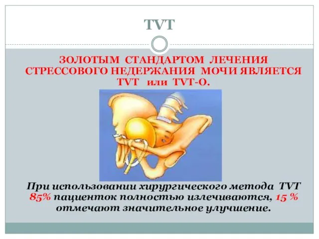 TVT ЗОЛОТЫМ СТАНДАРТОМ ЛЕЧЕНИЯ СТРЕССОВОГО НЕДЕРЖАНИЯ МОЧИ ЯВЛЯЕТСЯ TVT или