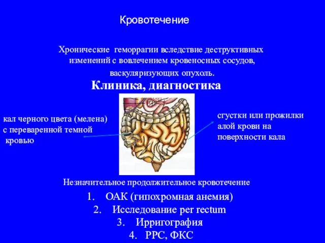 Клиника, диагностика Хронические геморрагии вследствие деструктивных изменений с вовлечением кровеносных