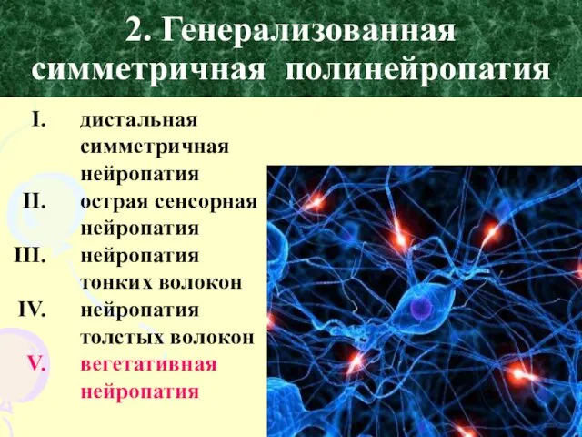 2. Генерализованная симметричная полинейропатия дистальная симметричная нейропатия острая сенсорная нейропатия