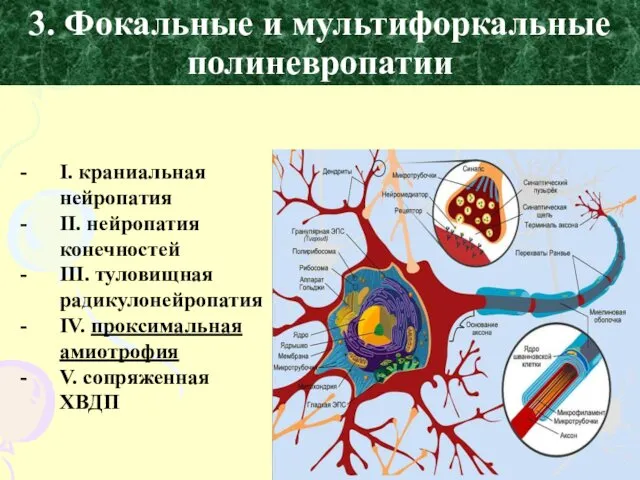 3. Фокальные и мультифоркальные полиневропатии I. краниальная нейропатия II. нейропатия
