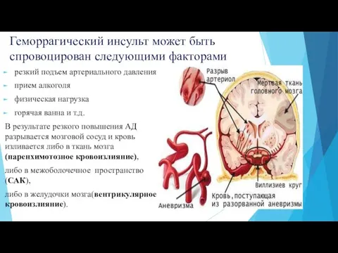 Геморрагический инсульт может быть спровоцирован следующими факторами резкий подъем артериального давления прием алкоголя