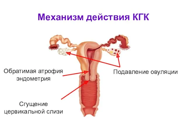 Механизм действия КГК Подавление овуляции Сгущение цервикальной слизи Обратимая атрофия эндометрия