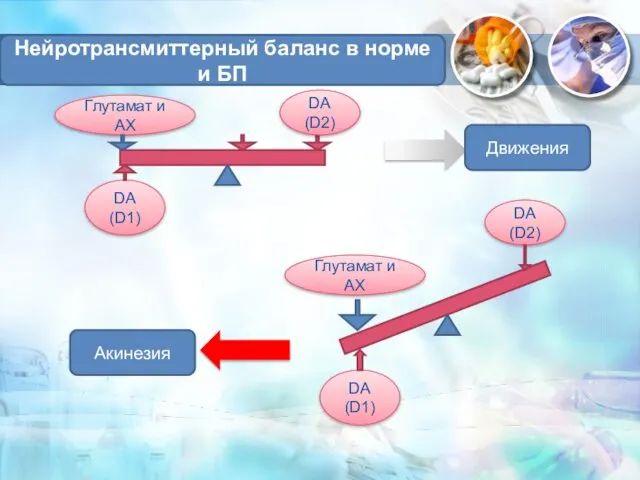 Нейротрансмиттерный баланс в норме и БП Глутамат и АХ DA