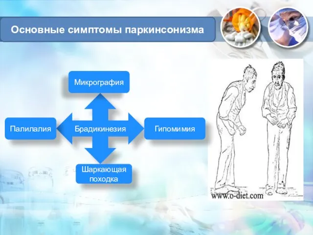 Основные симптомы паркинсонизма Брадикинезия Микрография Гипомимия Шаркающая походка Палилалия