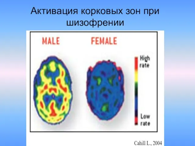 Активация корковых зон при шизофрении