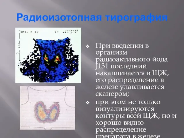 Радиоизотопная тирография При введении в организм радиоактивного йода J131 последний