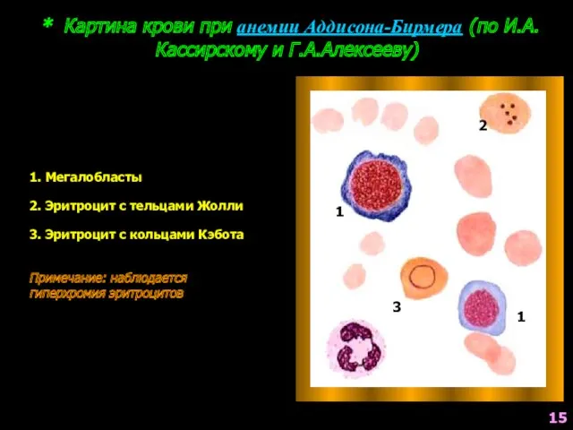 * Картина крови при анемии Аддисона-Бирмера (по И.А.Кассирскому и Г.А.Алексееву)