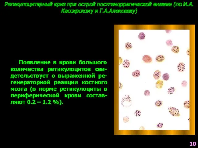 Ретикулоцитарный криз при острой постгеморрагической анемии (по И.А.Кассирскому и Г.А.Алексееву)