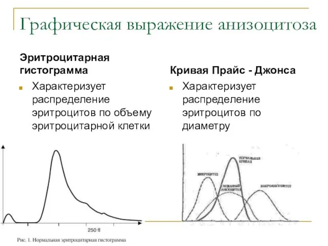 Графическая выражение анизоцитоза Эритроцитарная гистограмма Характеризует распределение эритроцитов по объему