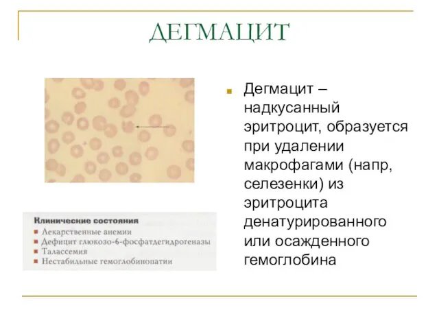 ДЕГМАЦИТ Дегмацит – надкусанный эритроцит, образуется при удалении макрофагами (напр,