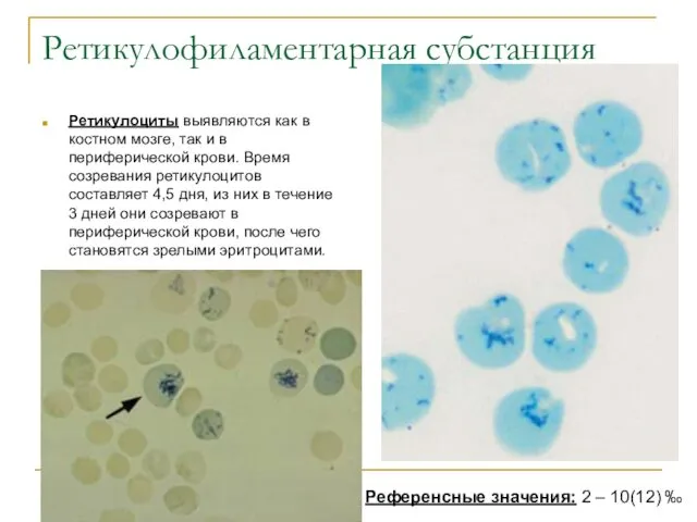 Ретикулофиламентарная субстанция Ретикулоциты выявляются как в костном мозге, так и