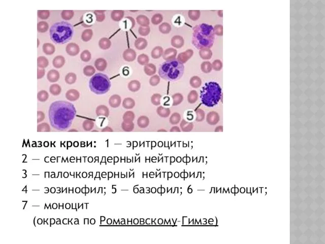 Мазок крови: 1 — эритроциты; 2 — сегментоядерный нейтрофил; 3