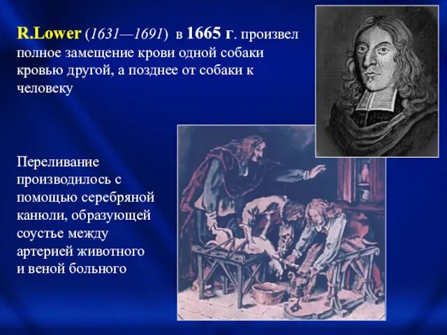 R.Lower (1631—1691) в 1665 г. произвел полное замещение крови одной