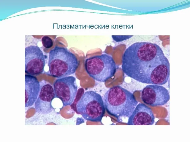 Плазматические клетки