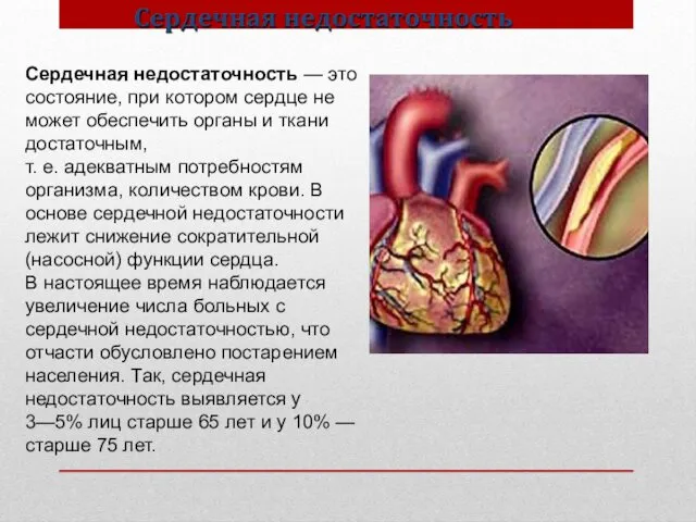 Сердечная недостаточность — это состояние, при котором сердце не может