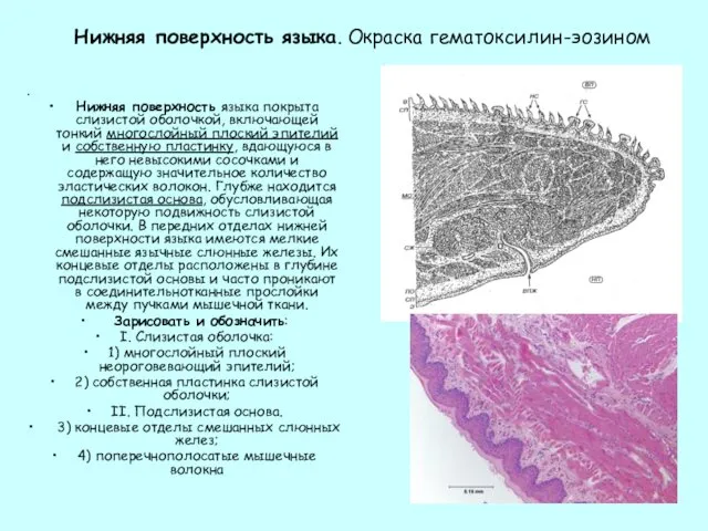 Нижняя поверхность языка. Окраска гематоксилин-эозином . Нижняя поверхность языка покрыта