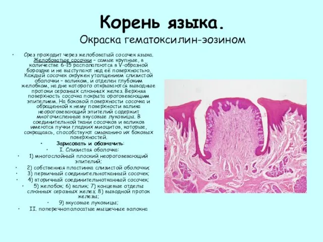 Корень языка. Окраска гематоксилин-эозином Срез проходит через желобоватый сосочек языка.