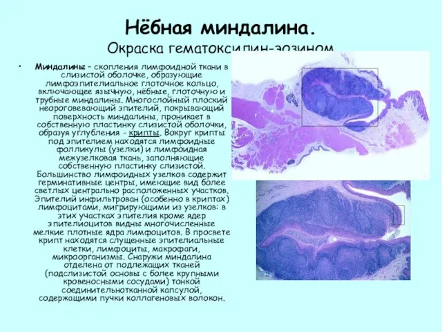 Нёбная миндалина. Окраска гематоксилин-эозином Миндалины – скопления лимфоидной ткани в