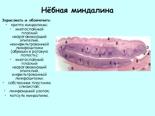 Нёбная миндалина Зарисовать и обозначить: крипта миндалины; многослойный плоский неороговевающий