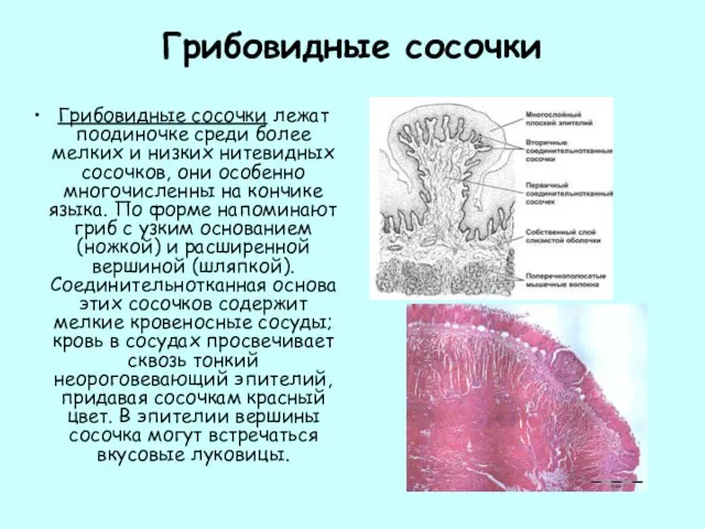 Грибовидные сосочки Грибовидные сосочки лежат поодиночке среди более мелких и