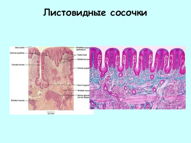 Листовидные сосочки