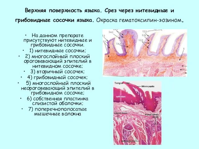 Верхняя поверхность языка. Срез через нитевидные и грибовидные сосочки языка.