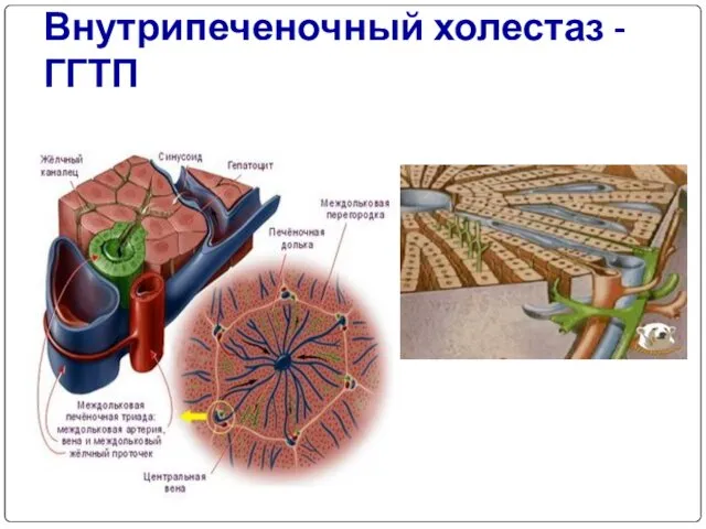 Внутрипеченочный холестаз - ГГТП