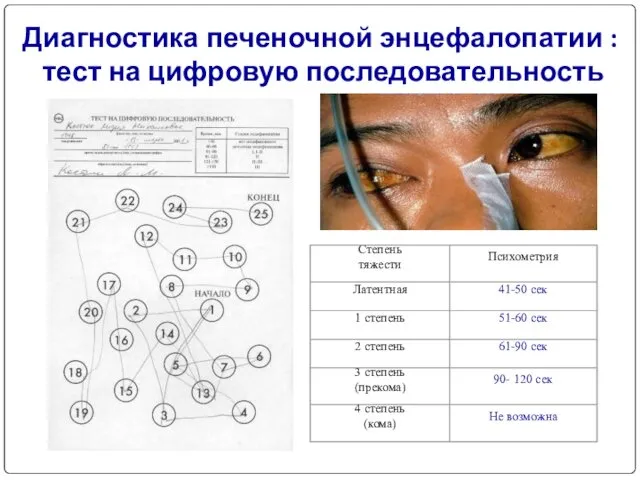 Диагностика печеночной энцефалопатии : тест на цифровую последовательность