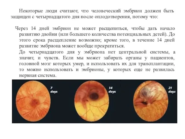 Некоторые люди считают, что человеческий эмбрион должен быть защищен с