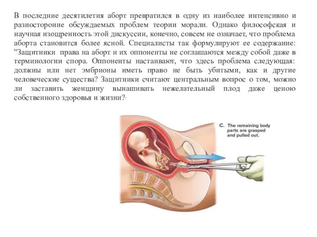 В последние десятилетия аборт превратился в одну из наиболее интенсивно