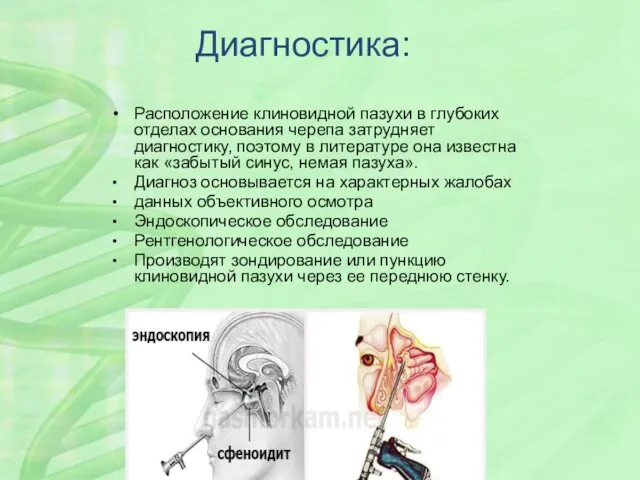 Диагностика: Расположение клиновидной пазухи в глубоких отделах основания черепа затрудняет