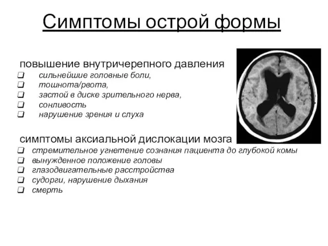 Симптомы острой формы повышение внутричерепного давления сильнейшие головные боли, тошнота/рвота,