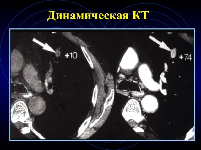 Динамическая КТ
