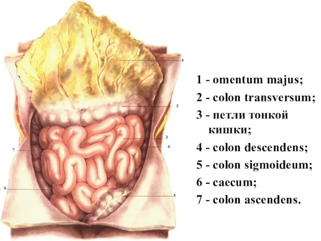 1 - omentum majus; 2 - colon transversum; 3 - петли тонкой кишки;