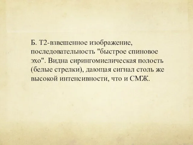 Б. Т2-взвешенное изображение, последовательность "быстрое спиновое эхо". Видна сирингомиелическая полость