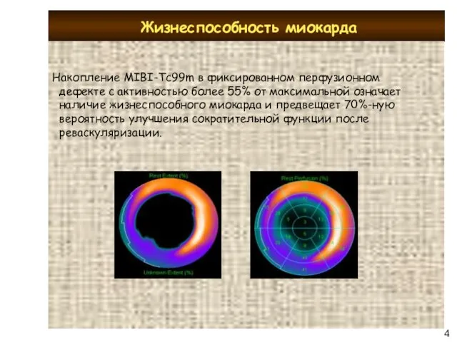 Жизнеспособность миокарда 47 Накопление MIBI-Tc99m в фиксированном перфузионном дефекте с