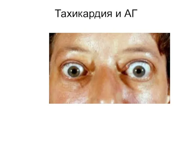 Тахикардия и АГ