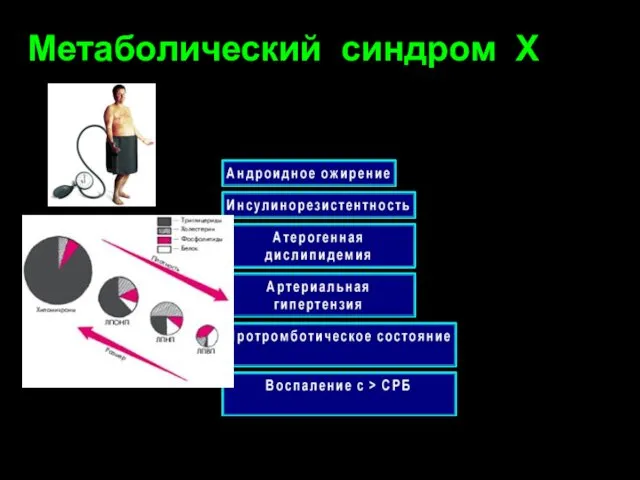 Метаболический синдром Х