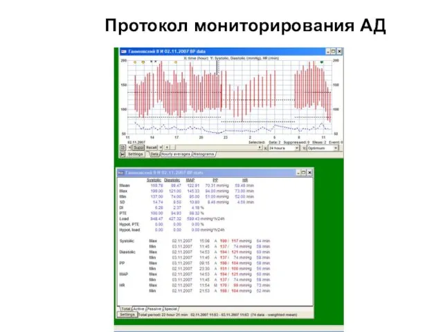 Протокол мониторирования АД