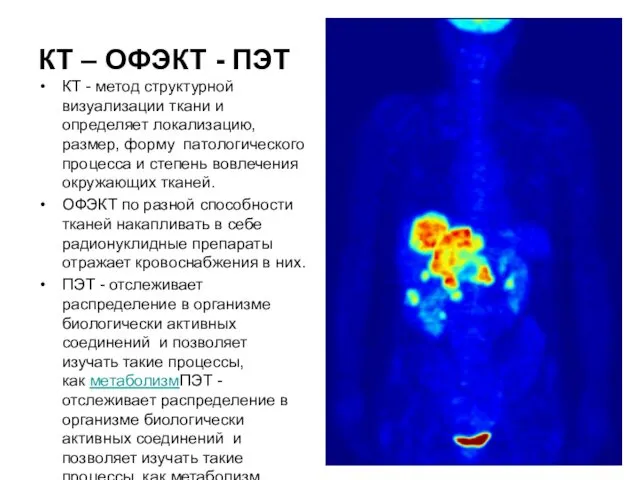 КТ – ОФЭКТ - ПЭТ КТ - метод структурной визуализации