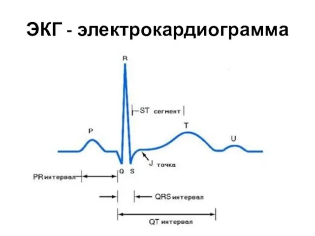 ЭКГ - электрокардиограмма