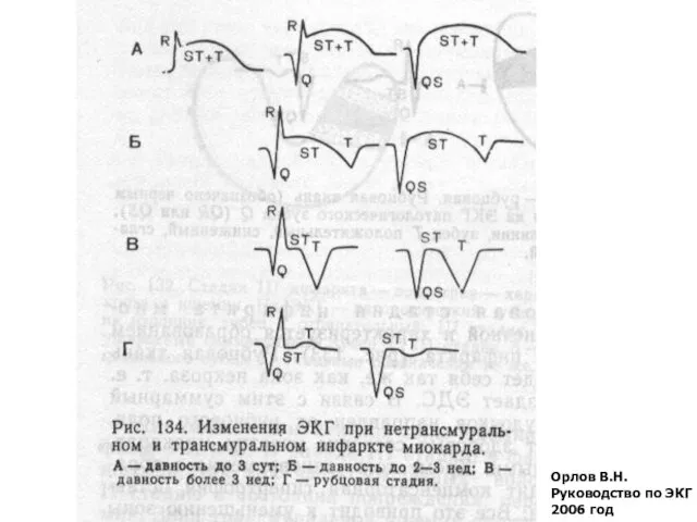 Орлов В.Н. Руководство по ЭКГ 2006 год