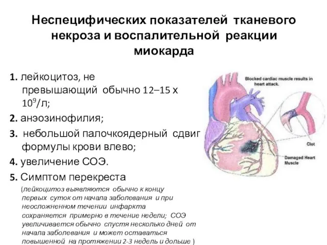 Неспецифических показателей тканевого некроза и воспалительной реакции миокарда 1. лейкоцитоз,