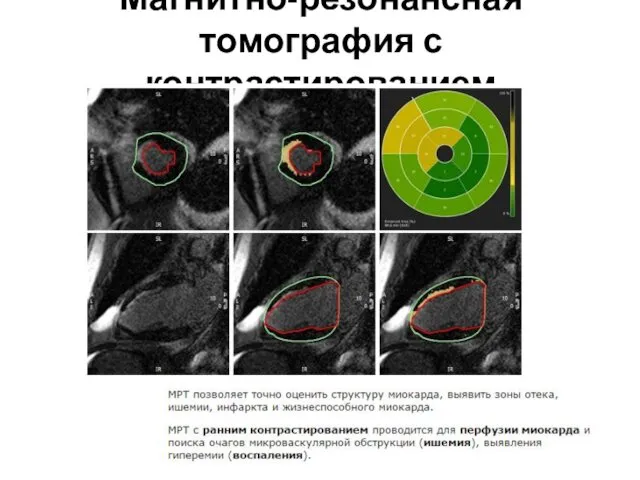 Магнитно-резонансная томография с контрастированием