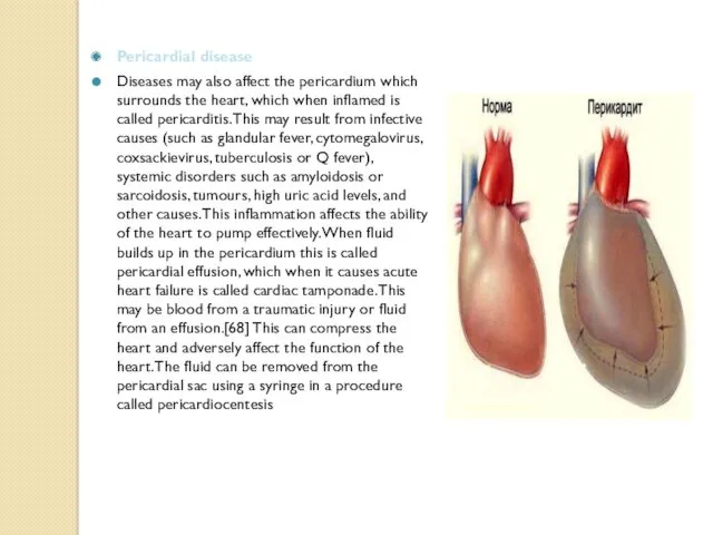 Pericardial disease Diseases may also affect the pericardium which surrounds