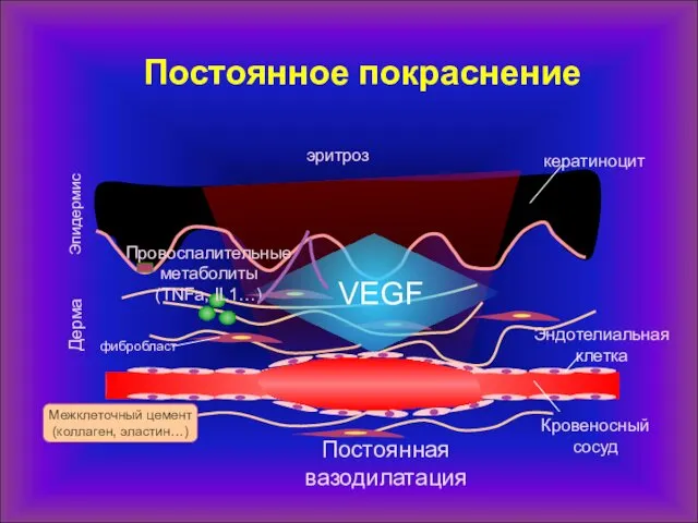 Эпидермис кератиноцит Эндотелиальная клетка Дерма Кровеносный сосуд фибробласт Межклеточный цемент