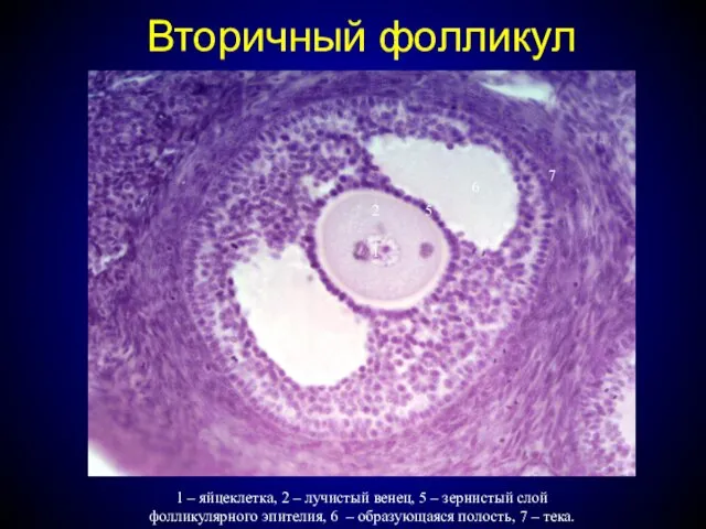 Вторичный фолликул 1 – яйцеклетка, 2 – лучистый венец, 5